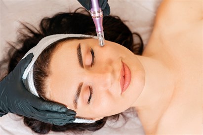 Mezoterapia mikroigłowa twarzy, szyi i dekoltu w Ninails & Beauty Warszawa (Wilanów)