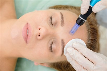 Mezoterapia mikroigłowa twarzy, szyi i dekoltu w Ninails & Beauty Warszawa (Wilanów)