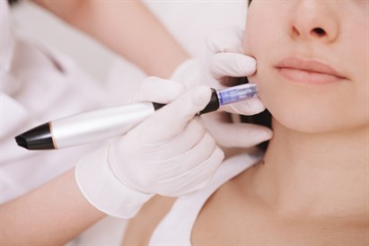 Mezoterapia mikroigłowa twarzy, szyi i dekoltu w Ninails & Beauty Warszawa (Wilanów)